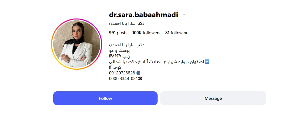 دکتر سارا بابا احمدی تزریق ژل لب روسی اصفهان