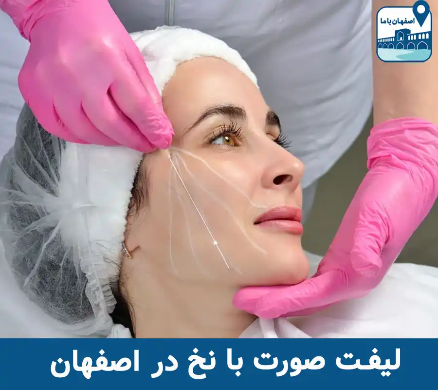 لیفت صورت با نخ در اصفهان