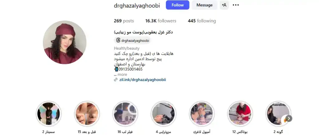 دکتر غزل یعقوبی تزریق ژل لب روسی در اصفهان