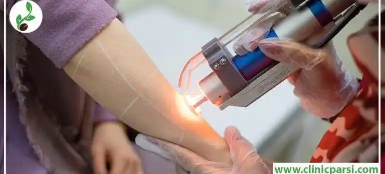 بهترین کلینیک لیزر موهای زائد در اصفهان