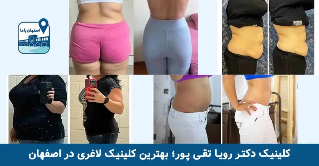 کلینیک دکتر تقی پور؛ بهترین کلینیک لاغری در اصفهان