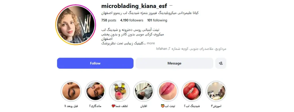 کیانا علیمردانی میکروبلیدینگ در اصفهان