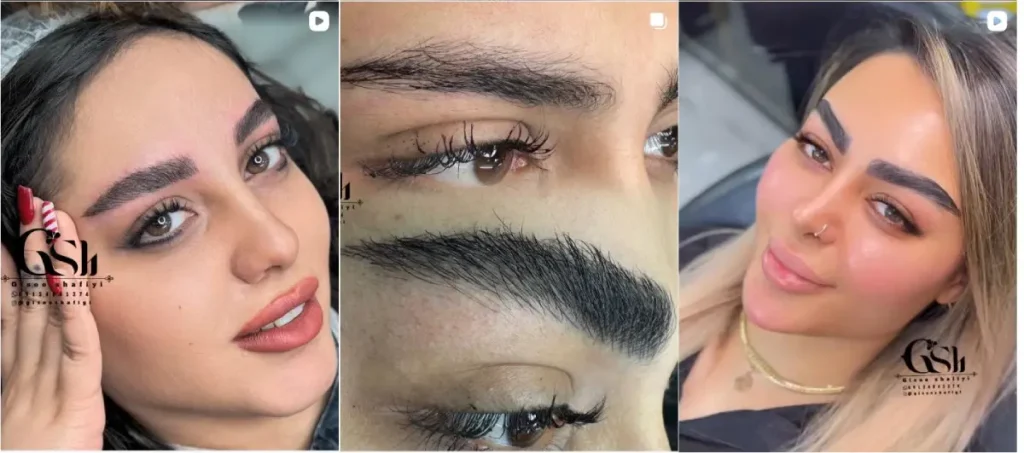 نمونه فیبروز ابرو اصفهان گیسو شفیعی