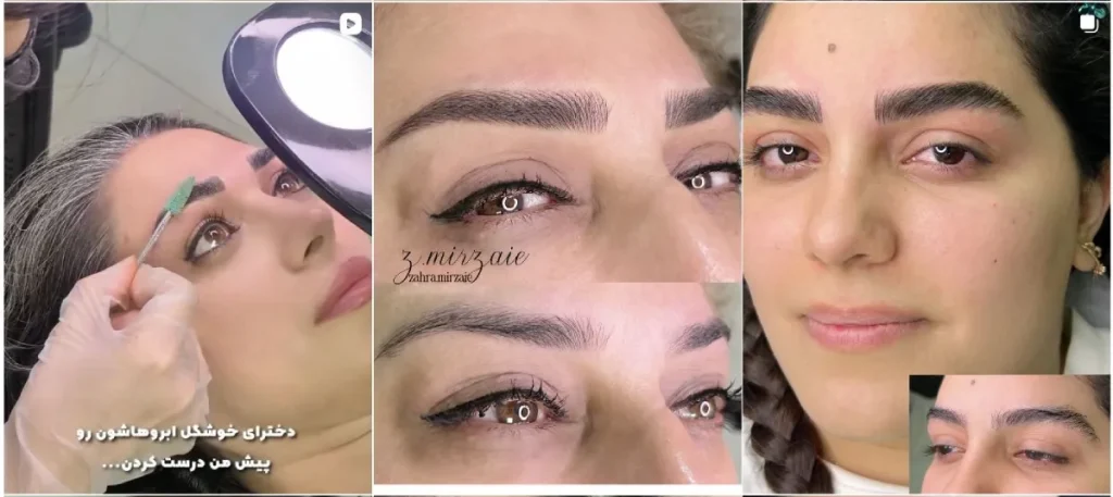 نمونه فیبروز ابرو زهرا میرزایی