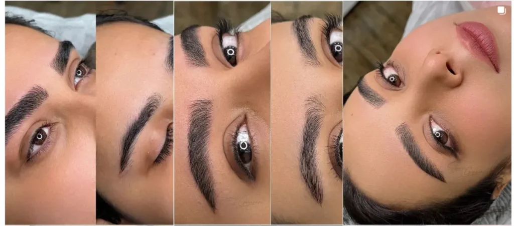 نمونه فیبروز ابرو سمیه گوگونانی