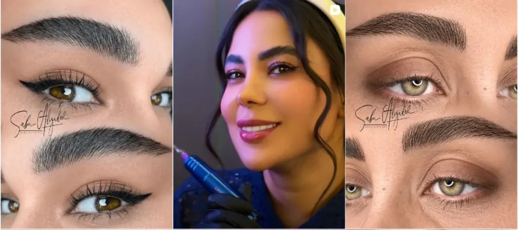 نمونه فیبروز ابرو صبا علیزاده