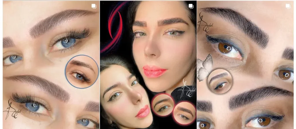 نمونه فیبروز ابرو عاطفه محمدی