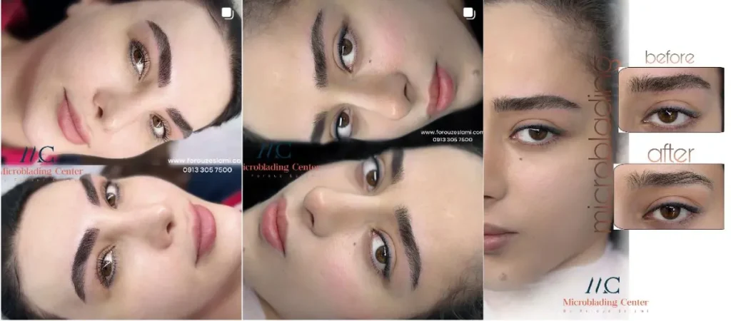 نمونه فیبروز ابرو فروز اسلامی
