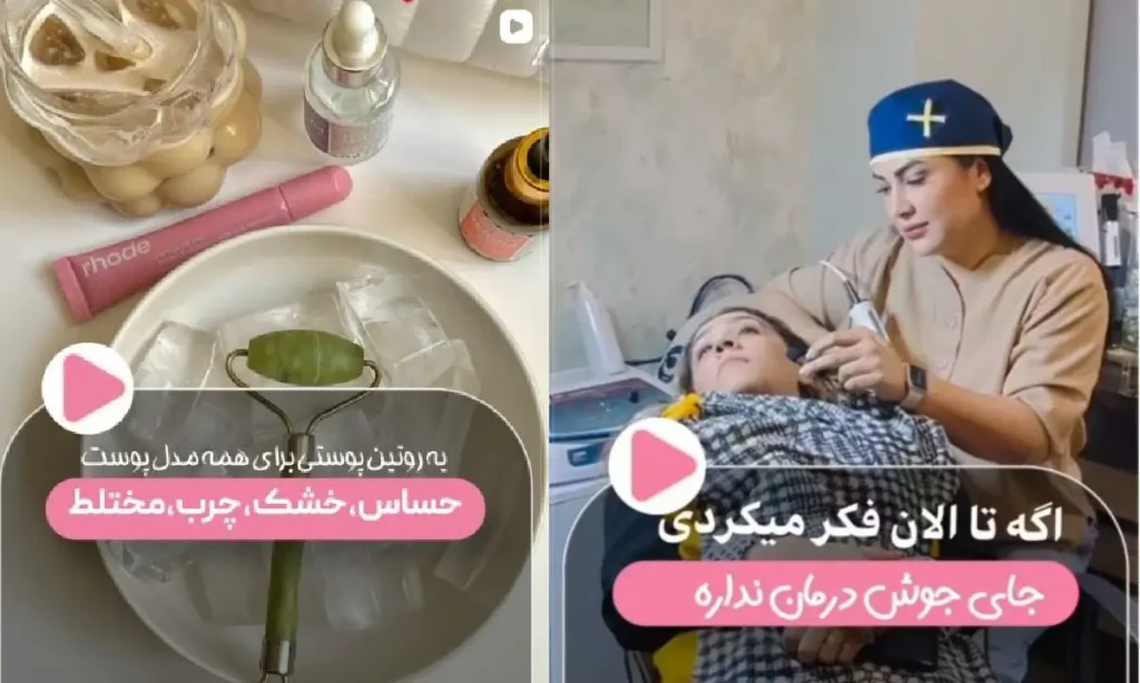 نمونه کار مرکز زیبایی لیلیوم