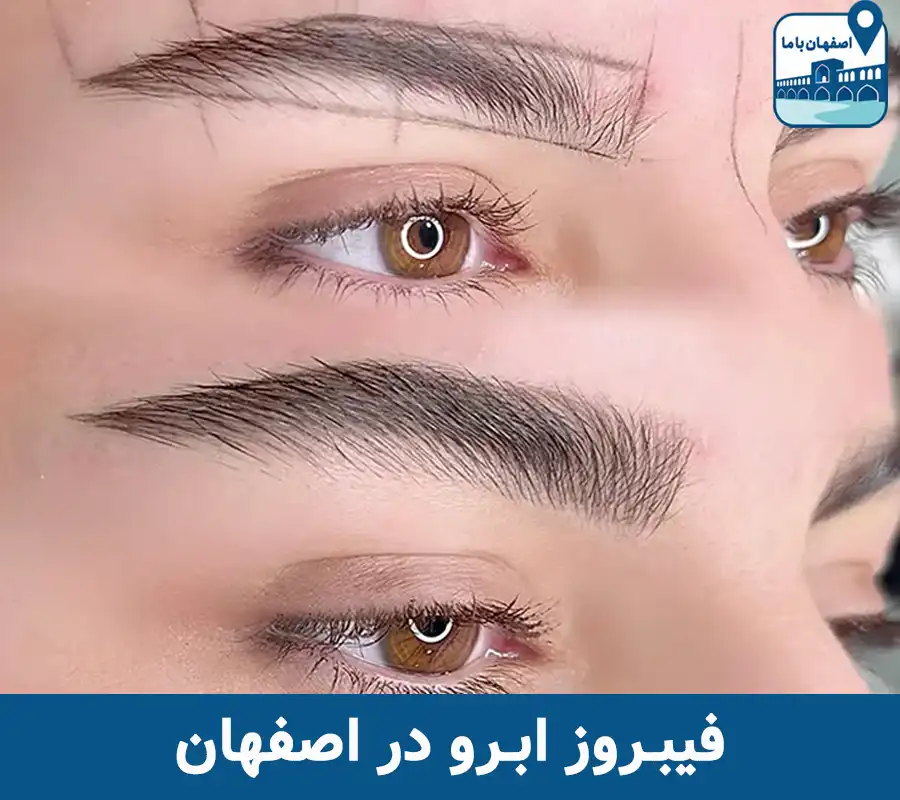 بهترین فیبروز ابرو در اصفهان